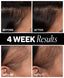 Sponsored (6 Month Supply)