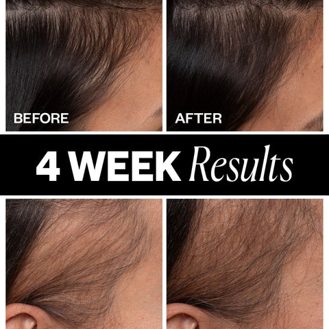SPONSORED Hair Density Scalp Treatment — Retail 3